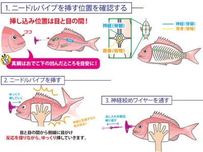 画像3: ルミカ(LUMICA)☆神経絞めセット SUPER LONG A20277
